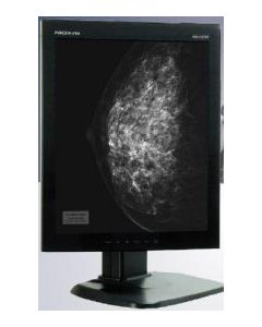 MMD-5201 - 20.1 " diagnostic grayscale monitor